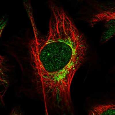 Immunocytochemistry/Immunofluorescence: HIBCH Antibody [NBP1-85891] - Immunofluorescent staining of human cell line U-2 OS shows localization to nucleoplasm & mitochondria.