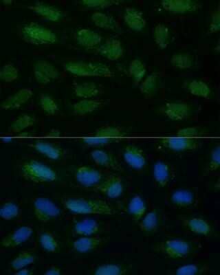 Immunocytochemistry/Immunofluorescence: HIBCH Antibody [NBP3-15496] - Immunofluorescence analysis of U-2 OS cells using HIBCH antibody (NBP3-15496) at dilution of 1:100. Blue: DAPI for nuclear staining.