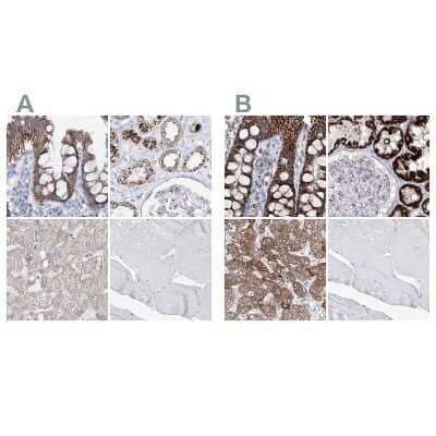 <b>Independent Antibodies Validation and Orthogonal Strategies Validation.</b>Immunohistochemistry-Paraffin: HIBCH Antibody [NBP1-85891] - Staining of human colon, kidney, liver and skeletal muscle using Anti-HIBCH antibody NBP1-85891 (A) shows similar protein distribution across tissues to independent antibody NBP2-32669 (B).