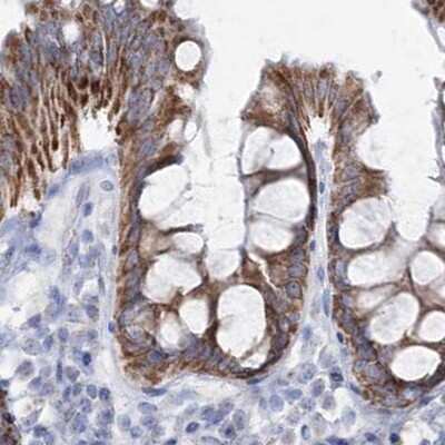Immunohistochemistry-Paraffin: HIBCH Antibody [NBP1-85891] - Staining of human colon.