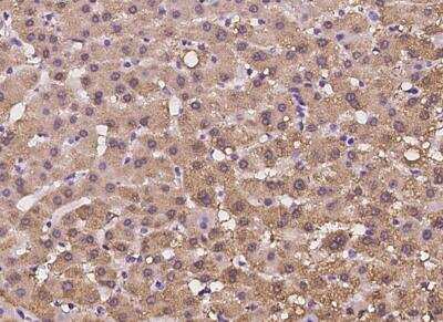 Immunohistochemistry-Paraffin: HIBCH Antibody [NBP3-06399] - Staining of human HIBCH in human liver with rabbit polyclonal antibody at 1:100 dilution.