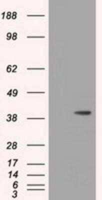 Western Blot: HIBCH Antibody (OTI3H5) - Azide and BSA Free [NBP2-71796] - HEK293T cells were transfected with the pCMV6-ENTRY control (Left lane) or pCMV6-ENTRY HIBCH (Right lane) cDNA for 48 hrs and lysed. Equivalent amounts of cell lysates (5 ug per lane) were separated by SDS-PAGE and immunoblotted with anti-HIBCH.