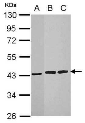 Western Blot: HIBCH Antibody [NBP1-32964] - Sample (30 ug of whole cell lysate) A: 293T B: HepG2 C: Molt-4 10% SDS PAGE; antibody diluted at 1:1000.