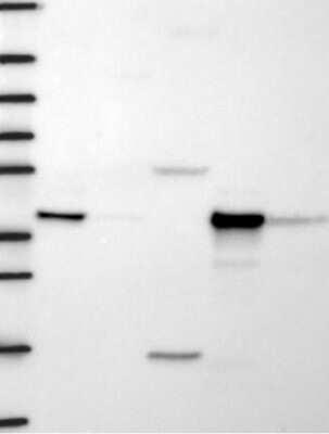 Western Blot: HIBCH Antibody [NBP3-17865] - Lane 1: Marker [kDa] 250, 130, 95, 72, 55, 36, 28, 17, 10;   Lane 2: RT4;   Lane 3: U-251 MG;   Lane 4: Human Plasma;   Lane 5: Liver;   Lane 6: Tonsil
