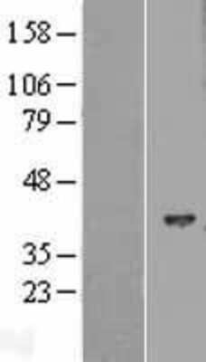 Western Blot: HIBCH Overexpression Lysate (Adult Normal) [NBL1-11538] Left-Empty vector transfected control cell lysate (HEK293 cell lysate); Right -Over-expression Lysate for HIBCH.