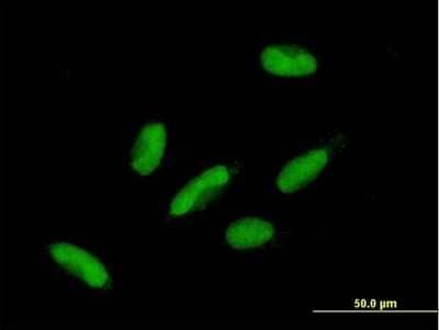 Immunocytochemistry/Immunofluorescence: HIC2 Antibody [H00023119-B01P] - Analysis of purified antibody to HIC2 on HepG2 cell. (antibody concentration 10 ug/ml)