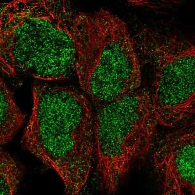 Immunocytochemistry/Immunofluorescence: HIC2 Antibody [NBP2-55846] - Staining of human cell line HEK 293 shows localization to nucleus.