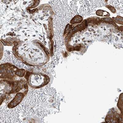 Immunohistochemistry-Paraffin: HIC2 Antibody [NBP1-81710] - Staining of human placenta shows strong cytoplasmic positivity in trophoblastic cells.