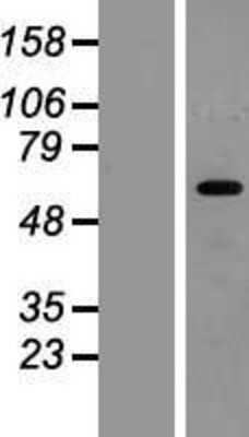 Western Blot: HIC2 Overexpression Lysate (Adult Normal) [NBP2-07213] Left-Empty vector transfected control cell lysate (HEK293 cell lysate); Right -Over-expression Lysate for HIC2.