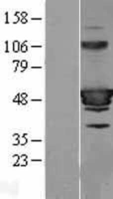 Western Blot: HIC5 Overexpression Lysate (Adult Normal) [NBL1-16853] Left-Empty vector transfected control cell lysate (HEK293 cell lysate); Right -Over-expression Lysate for HIC5.