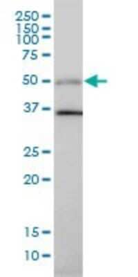 Western Blot: HIC5/TGFB1I1 Antibody (4B2-D8) [H00007041-M01] - TGFB1I1 monoclonal antibody (M01), clone 4B2-D8 Analysis of TGFB1I1 expression in Hela.