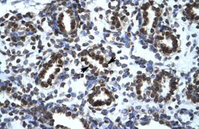 Immunohistochemistry: HIC5/TGFB1I1 Antibody [NBP3-10300] - Immunohistochemical analysis of human lung.