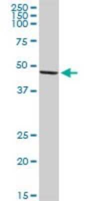 Western Blot: HIC5/TGFB1I1 Antibody [H00007041-D01P] - Analysis of TGFB1I1 expression in human pancreas.