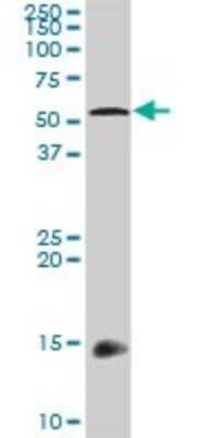 Western Blot HIC5/TGFB1I1 Antibody