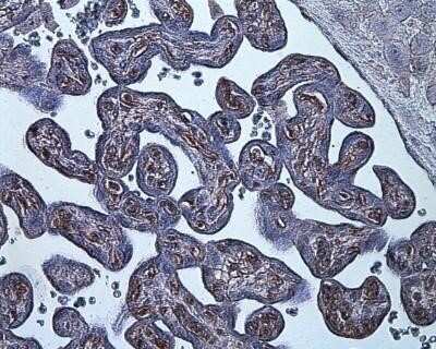 Immunohistochemistry: HIF-1 alpha Antibody (ESEE122) - Azide and BSA Free [NBP2-80762] - HIF-1 alpha staining in hypoxia-induced human placenta. Image from the standard format of this antibody.