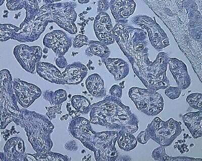 Immunohistochemistry: HIF-1 alpha Antibody (ESEE122) - Azide and BSA Free [NBP2-80762] - Negative control stain of human placenta (from sea level) using mouse IgG at 1:100. 4uM paraffin-embedded section. Image from the standard format of this antibody.