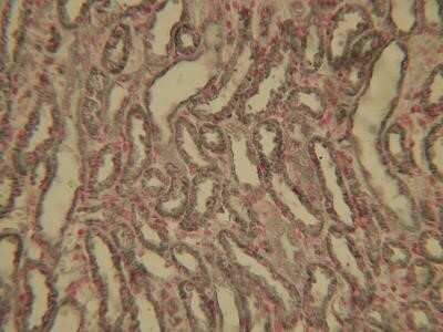 Immunohistochemistry-Paraffin: HIF-1 alpha Antibody (ESEE122) - Azide and BSA Free [NBP2-80762] - Analysis of HIF-1 alpha in paraffin-embedded mouse kidney tissue section using anti-HIF-1 alpha antibody. Image from verified customer review. Image from the standard format of this antibody.