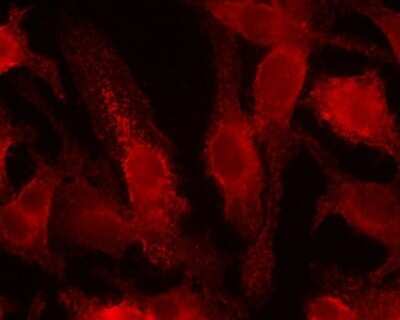 Immunocytochemistry/Immunofluorescence: HIF-1 alpha Antibody Pack [NB100-901IHC] - Detection of HIF-1 alpha (red dye 568) in a cultured raw mouse macrophage cell line, using NB100-131. 100X magnification. Photos courtesy of Susan Alexander and Hattie Gresham, PhD.