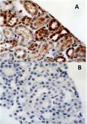 Immunohistochemistry: HIF-1 alpha Antibody Pack [NB100-901IHC] - Staining in normal mouse kidney showing (A) staining with antibody and (B) blocking peptide used at 10-fold excess concentration. Images provided by Dr Yves Heremans. Please see the product review of NBC1-18422 for additional details. HIF-1 alpha Antibody [NB100-479]
