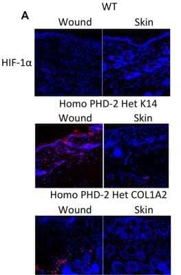 Immunohistochemistry: HIF-1 alpha Antibody Pack [NB100-901IHC] - Immunofluorescence of wounded tissue and normal unwounded skin. Representative images for immunofluorescent staining of HIF-1 alpha on healed wounded skin and adjacent normal unwounded skin of wild type, heterozygous K14-Cre/homozygous floxed PHD-2, and heterozygous Col1 alpha2-Cre-ER/homozygous floxed PHD-2 mice at 400x magnification. Image collected and cropped by CiteAb from the following publication (//doi.org/10.1371/journal.pone.0093373), licensed under a CC-BY license. HIF-1 alpha Antibody [NB100-479]