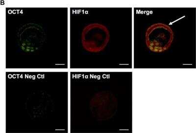 Immunohistochemistry: HIF-1 alpha Antibody Pack [NB100-901IHC] - Hif1alpha expression in preimplantation embryos. Co-staining of OCT4 and Hif1alpha in inner cell mass of blastocyst (top) and negative control images without primary antibodies (bottom). Scale bar: 30um. Image collected and cropped by CiteAb from the following publication (//dx.plos.org/10.1371/journal.pone.0154309) licensed under a CC-BY license. HIF-1 alpha Antibody [NB100-479]