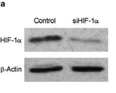 Knockdown Validated: HIF-1 alpha Antibody Pack [NB100-901IHC] - HIF-1 inhibits the apoptosis of hypoxic glioblastoma cells. U87MG cells were transfected with siRNA against HIF-1 alpha. Forty-eight hours after transfection, cells were incubated for 2 h in hypoxia (1% O2). HIF-1 alpha was detected by immunoblotting. beta-Actin was used as a loading control. The results are representative for three independent experiments. Image collected and cropped by CiteAb from the following publication (//www.nature.com/articles/cddis2013562) licensed under a CC-BY license. HIF-1 alpha Antibody (H1alpha67) [NB100-123]