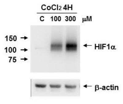 Western Blot: HIF-1 alpha Antibody Pack [NB100-901IHC] - HIF-1 alpha induction on Caki-1 cell lysate using CoCl2. Image from verified customer review. HIF-1 alpha Antibody [NB100-449]
