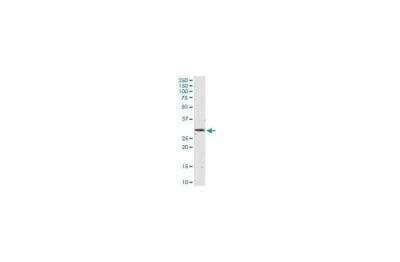 Western Blot: HIF-1 alpha [p Ser311, Hydroxy Thr299] Antibody (Clone) [Alexa Fluor® 555] - (Asp175) (CoCl2 Treated) - Pre-adsorbed [NB100-105L] - test1234