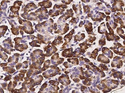 Immunohistochemistry: HIF-1 alpha [p Ser311, Hydroxy Thr299] Antibody (H1) [Alexa Fluor® 488] - (Asp175), (CoCl2 Treated) - Pre-adsorbed [NB100-105L] - test