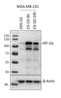 Western Blot: HIF-2 alpha/EPAS1 Antibody (2444A) - Azide and BSA Free [NBP2-80767] - Human MDA MB 231 cells. 50 ug cell lysate per lane. 10% SDS-PAGE. HIF-2 alpha antibody at 1:1000 in 5% milk. HRP-conjugated donkey anti-rabbit IgG polyclonal secondary antibody at 1:2000 in 5% milk. WB image submitted by a verified customer review. Image from the standard format of this antibody.