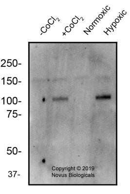 Western Blot: HIF-2 alpha/EPAS1 Antibody (2444A) - Azide and BSA Free [NBP2-80767] - Total protein from human U87 cells treated for 4 hours with and without 100 uM cobalt chloride (CoCl2) and under normoxic and hypoxic conditions, was separated on a 7.5% gel by SDS-PAGE, transferred to PVDF membrane and blocked in 5% non-fat milk in TBST. The membrane was probed with 2.0 ug/mL anti-HIF-2 alpha in 1% non-fat milk in TBST and detected with an anti-rabbit HRP secondary antibody using chemiluminescence. Image from the standard format of this antibody.