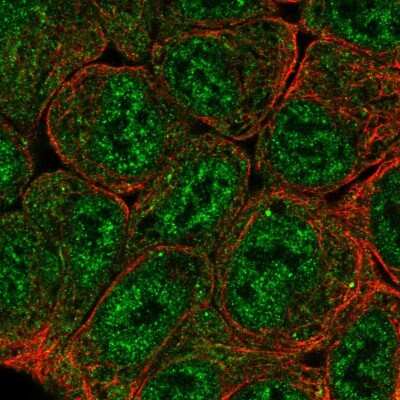 Immunocytochemistry/Immunofluorescence: HIF-2 alpha/EPAS1 Antibody [NBP2-58653] - Staining of human cell line RT4 shows localization to nucleoplasm & cytosol.