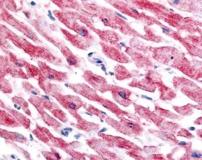 Immunohistochemistry: HIF-2 alpha/EPAS1 Antibody (ep190b) - Azide and BSA Free [NBP2-80766] - Analysis of HIF-2 in human cardiac myocytes using HIF-2 alpha/EPAS1 Antibody (ep190b). Image from the standard format of this antibody.