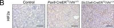 Immunohistochemistry: HIF-2 alpha/EPAS1 Antibody (ep190b) - Azide and BSA Free [NBP2-80766] - Renal tubule specific models of Vhl deletion. Histological images of representative renal sections from 12 month old control, Pax8-CreERT2/Vhldelta/delta and Slc22a6-CreERT2/Vhldelta/delta mice (stains and antibodies as indicated, arrowheads indicate abno