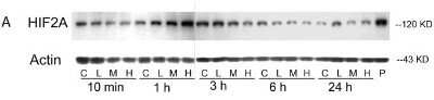 Western Blot: HIF-2 alpha/EPAS1 Antibody (ep190b) - Azide and BSA Free [NBP2-80766] - 4-OOHCPA exposure induced HIF-2 alpha/EPAS1. A: Western blot analysis of HIF-2 alpha/EPAS1 protein (118KD) and actin (43KD) in limbs at 10 min, 1, 3, 6, and 24 h after treatment with 4-OOHCPA at 0.3 ug/mL (L) 1.0 ug/mL (M) or 3.0 ug/mL (H). P represents the positive control. Image collected and cropped by CiteAb from the following publication (//dx.plos.org/10.1371/journal.pone.0051937), licensed under a CC-BY license. Image from the standard format of this antibody.