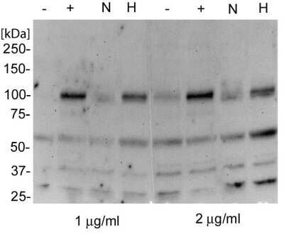 Western Blot: HIF-2 alpha/EPAS1 Antibody (ep190b) - Azide and BSA Free [NBP2-80766] - Analysis of HepG2 without Cobalt (II) Chloride (1), HepG2 with Cobalt (II) Chloride (2), HepG2 normoxic (3), HepG2 hypoxic (4), HepG2 without Cobalt (II) Chloride (5), HepG2 with Cobalt (II) Chloride (6), HepG2 normoxic (7), and HepG2 hypoxic (8) using this antibody (NB100-132) at 1 - 2 ug/mL. Image from the standard format of this antibody.