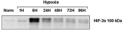 Western Blot: HIF-2 alpha/EPAS1 Antibody (ep190b) - Azide and BSA Free [NBP2-80766] - Analysis of HIF-2 alpha stabilization over time in 791T cells following exposure to hypoxia. [PMID: 23785417]. Image using the HRP form of this antibody. Image from the standard format of this antibody.