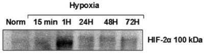 Western Blot: HIF-2 alpha/EPAS1 Antibody (ep190b) - Azide and BSA Free [NBP2-80766] - Analysis of HIF-2 alpha stabilization over time in HOS cells following exposure to hypoxia. [PMID: 23785417]. Image using the HRP form of this antibody. Image from the standard format of this antibody.