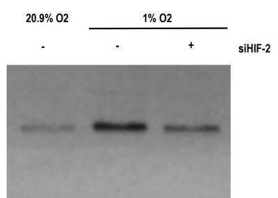 Western Blot: HIF-2 alpha/EPAS1 Antibody (ep190b) - Azide and BSA Free [NBP2-80766] - Mouse aortic endothelial cells treated (1%) or not treated (20.9%) in hypoxia for 3 hrs. Cells where also transfected with a specific siRNA against (siHIF-2) or a control siRNA (-). Western blot image submitted by a verified customer review. Image from the standard format of this antibody.