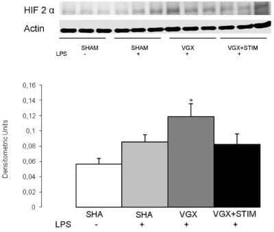 Western Blot: HIF-2 alpha/EPAS1 Antibody (ep190b) - Azide and BSA Free [NBP2-80766] - Western blot analysis and quantification of HIF-2 alpha expression in the cortex 4.5 hours after lipopolysaccharide (LPS) administration for all LPS groups and the control group (SHAM, white bar). With the exception of the vagotomy group (VGX LPS, gray bar), no significant differences to the SHAM group were found in the LPS-treated and sham-operated (SHAM+LPS, light gray bar) or vagus nerve-stimulated groups (VGX LPS+STIM, black bar). The significant increase in the VGX LPS (gray bar) group is an indicator of a hypoxic condition; * P<0.05 compared to SHAM; n=6 rats each. Data are given as the mean+/-SEM. Image collected and cropped by CiteAb from the following publication (//jneuroinflammation.biomedcentral.com/articles/10.1186/1742-2094-9-183), licensed under a CC-BY license. Image from the standard format of this antibody.