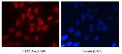 Immunocytochemistry: HIF Prolyl Hydroxylases Antibody Pack [NB100-903PHD] - EGLN1/PHD2 Antibody [NB100-137] - Staining of endogenous PHD2 in U2OS cells. ICC image submitted by a verified customer review. EGLN1/PHD2 Antibody [NB100-137]