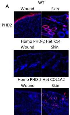 Immunohistochemistry: HIF Prolyl Hydroxylases Antibody Pack [NB100-903PHD] - Immunofluorescence of wounded tissue and normal unwounded skin. Representative images for immunofluorescent staining of PHD-2 on healed wounded skin and adjacent normal unwounded skin of wild type, heterozygous K14-Cre/homozygous floxed PHD-2, and heterozygous Col1 alpha2-Cre-ER/homozygous floxed PHD-2 mice at 400x magnification. Image collected and cropped by CiteAb from the following publication (//doi.org/10.1371/journal.pone.0093373), licensed under a CC-BY license. EGLN1/PHD2 Antibody [NB100-2219]