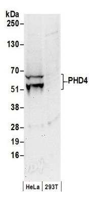 Western Blot: HIF Prolyl Hydroxylases Antibody Pack [NB100-903PHD] - Whole cell lysate (50 ug) from HeLa and 293T cells prepared using NETN lysis buffer. Antibody: Affinity purified rabbit anti-PHD4 antibody used for WB at 0.4 ug/mL. Detection: Chemiluminescence with an exposure time of 30 seconds. PHD4/HIF Prolyl Hydroxylase 4 Antibody [NB100-295]