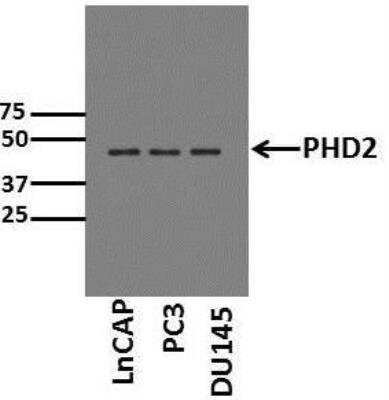 Western Blot: HIF Prolyl Hydroxylases Antibody Pack [NB100-903PHD] - Analysis of PHD2 expression in human prostate cancer cell lines. WB image submitted by a verified customer review. EGLN1/PHD2 Antibody [NB100-137]