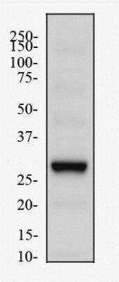 Western Blot: HIF Prolyl Hydroxylases Antibody Pack [NB100-903PHD] - Whole cell protein from MEF cells was separated on a 12% gel by SDS-PAGE, transferred to PVDF membrane and blocked in 5% non-fat milk in TBST. The membrane was probed with 2 ug/mL anti-EGLN3/PHD3 in 1% milk, and detected with an anti-rabbit HRP secondary antibody using chemiluminescence. EGLN3/PHD3 Antibody [NB100-303]