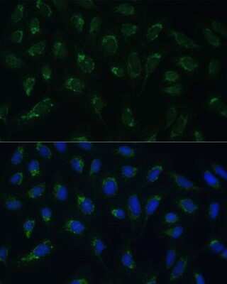 Immunocytochemistry/ Immunofluorescence HIGD1A Antibody - Azide and BSA Free