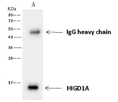 Immunoprecipitation: HIGD1A Antibody [NBP2-97800] - HIGD1A was immunoprecipitated using: Lane A: 0.5 mg HepG2 Whole Cell Lysate 4 ul anti-HIGD1A rabbit polyclonal antibody and 60 ug of Immunomagnetic beads Protein A/G.  Primary antibody: Anti-HIGD1A rabbit polyclonal antibody, at 1:100 dilution. Secondary antibody: Goat Anti-Rabbit IgG (H+L)/HRP at 1/10000 dilution. Developed using the ECL technique. Performed under reducing conditions. Predicted band size: 12 kDa. Observed band size: 12 kDa