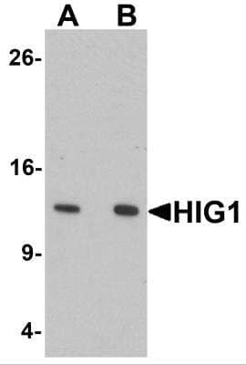 Western Blot: HIGD1A Antibody [NBP2-81721] - Western Blot analysis of HIGD1A in 293 cell lysate with HIGD1A antibody at (A) 0.5 and (B) 1 ug/ml.