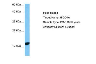 Western Blot: HIGD1A Antibody [NBP2-83044] - Host: Rabbit. Target Name: HIGD1A. Sample Tissue: Human PC-3 Whole Cell lysates. Antibody Dilution: 1ug/ml