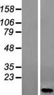 Western Blot: HIGD1A Overexpression Lysate (Adult Normal) [NBP2-09315] Left-Empty vector transfected control cell lysate (HEK293 cell lysate); Right -Over-expression Lysate for HIGD1A.